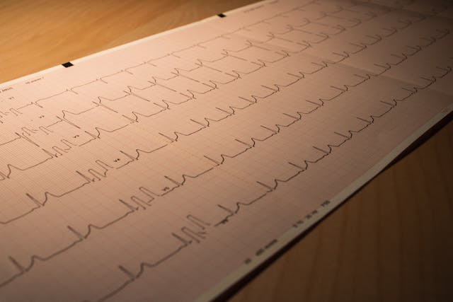 Impara la differenza tra un infarto, un arresto cardiaco e un ictus: potresti salvare una vita